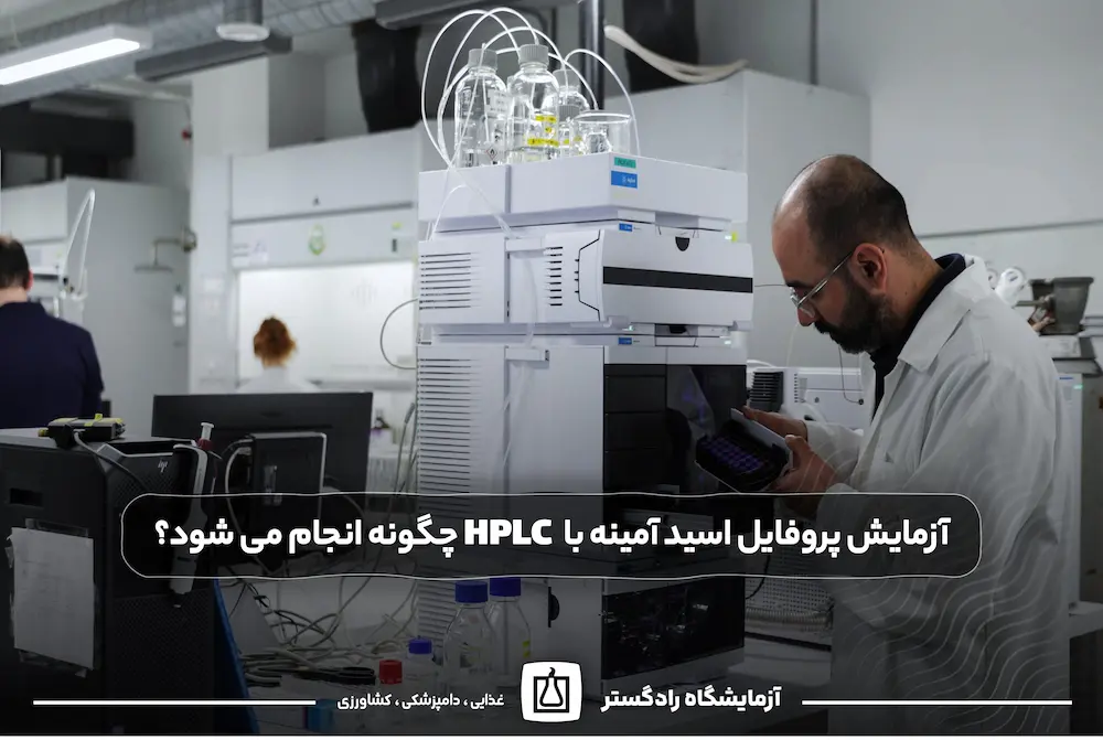 آزمایش پروفایل اسید آمینه با HPLC چگونه انجام می شود؟ | کروماتوگرام پروفایل اسید آمینه
